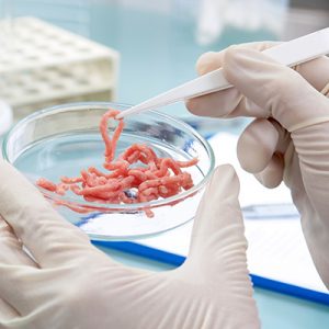 foodborne pathogens